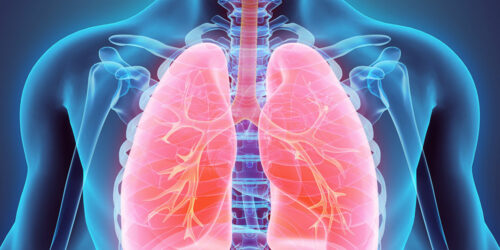 Everything you should know about lung cancer