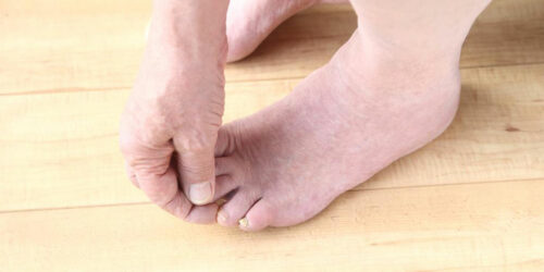 Fibromyalgia Foot Pain &#8211; Factors to Understand