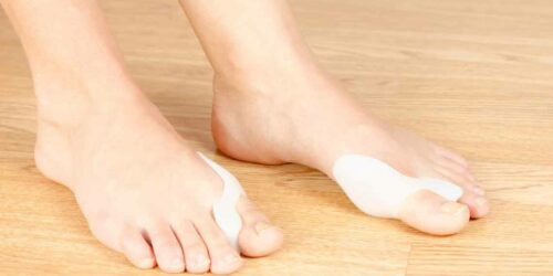 Find Relief in the Right Kind of Shoes for Bunions