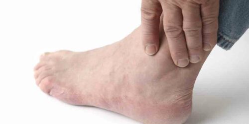 Find relief with these 5 home remedies for foot pain