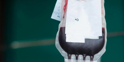 Know More About Public Cord Blood Banking