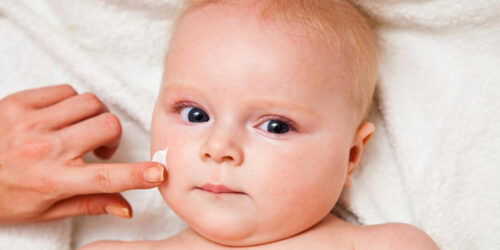 Know More About The Symptoms Causes And Treatment Options For Eczema In Infants