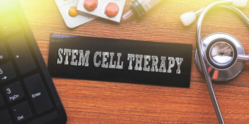 Know More about Better Stem Cell Therapy Options