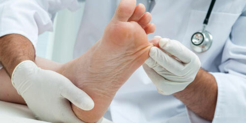 Know How Listerine Can Cure Your Toenail Fungus