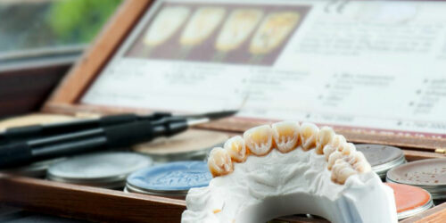 Know about the Average Cost of Dental Implants and Its Benefits