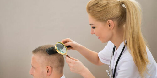 Know about the Best Hair Loss Treatments