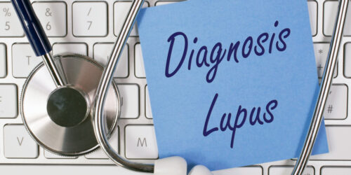 Know about the different ways to diagnose lupus