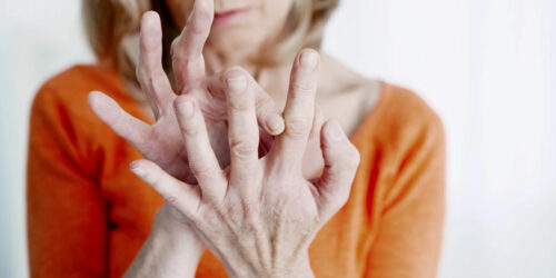 Know the Common Symptoms Of Rheumatoid Arthritis