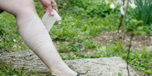 How Can Compression Hose Help With Varicose Veins And How Can You Buy Them