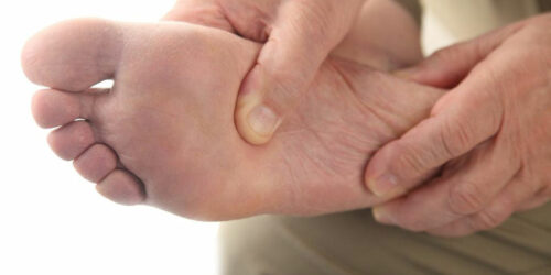 How Can You Know If You Are Suffering from Gout Foot Pain