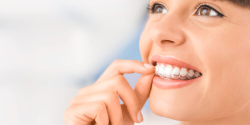 How and why are crowded teeth fixed