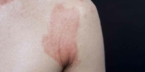 How to identify a skin rash