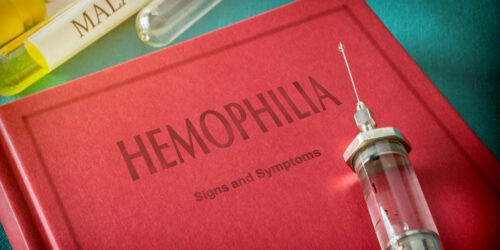 Hemophilia &#8211; 4 main symptoms and their severity