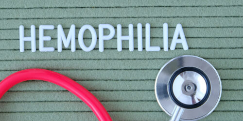 Hemophilia &#8211; Early signs and ways to manage the condition