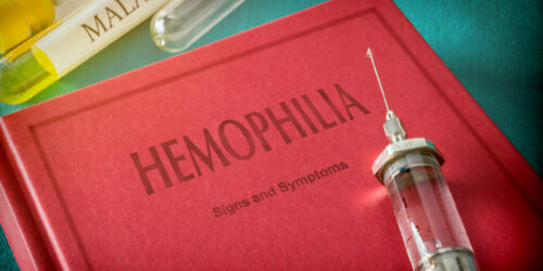 Hemophilia &#8211; Symptoms to look out for