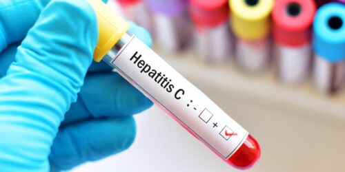 Hepatitis &#8211; types and contributing factors