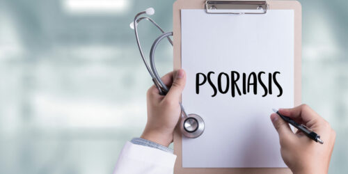 Here are Some Treatment Options for Psoriasis