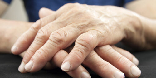 Here is what you must know about rheumatoid arthritis