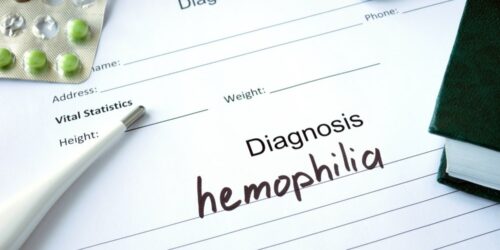 Here&#8217;s what to eat for hemophilia