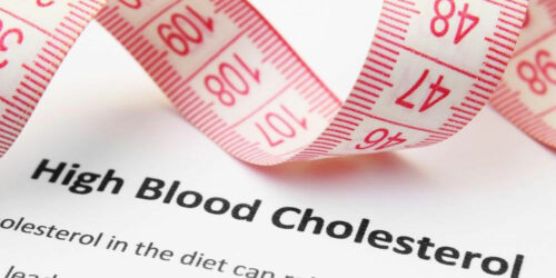 High Cholesterol &#8211; Symptoms and Treatment Options