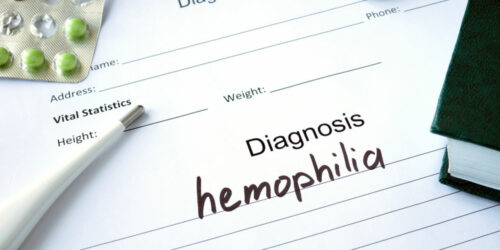 Must Know Facts About Hemophilia