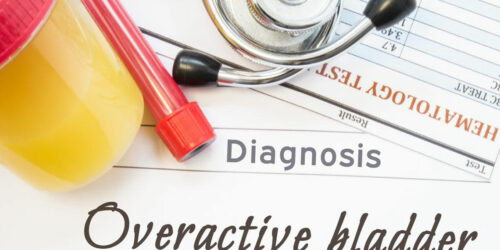 Natural Ways to Deal with an Overactive Bladder