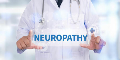 Neuropathy &#8211; Types, Causes, and Symptoms