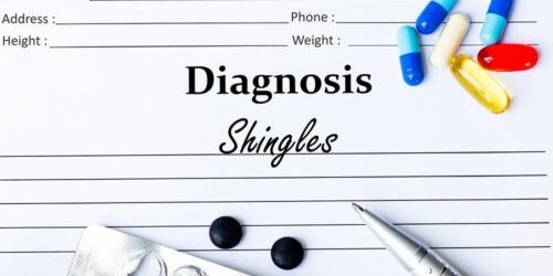 Shingles &#8211; Symptoms, Risk Factors, and Treatments