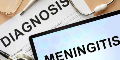 Signs You Might be Suffering from Meningitis