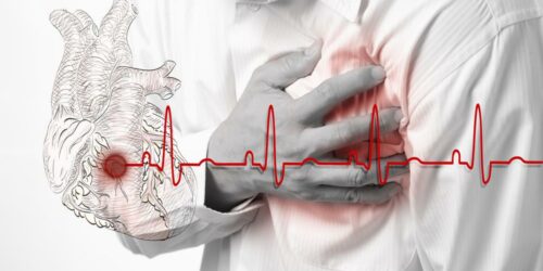 Symptoms And Treatment For Atrial Fibrillation