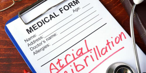 Symptoms, Diagnosis and Treatment of Atrial Fibrillation