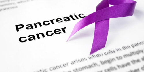 Symptoms of pancreatic cancer