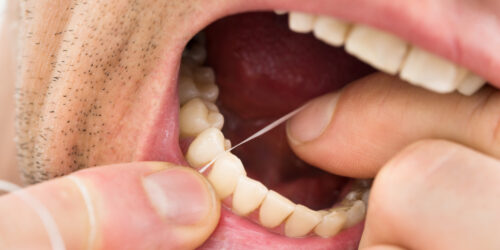 Removing Dental Plaque At Home