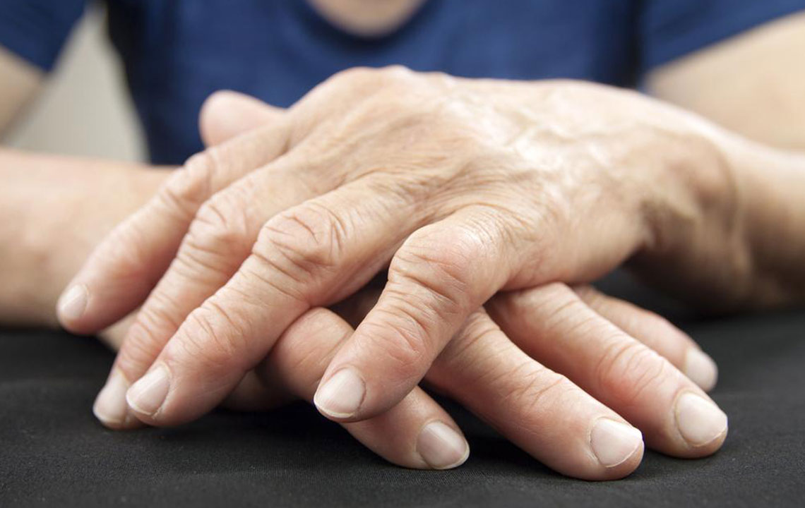 Rheumatoid Arthritis &#8211; Symptoms, Causes, and Remedies