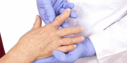 Rheumatoid Arthritis and Types of Doctors who can Undertake Treatment