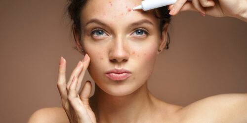 Ways To Manage Sensitive Skin Problems