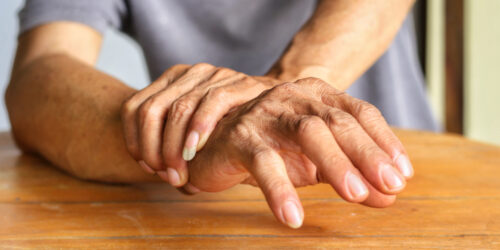 Ways To Manage Psoriatic Arthritis With Lifestyle Changes