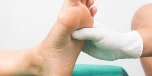 Ways to Deal with Diabetic Neuropathy