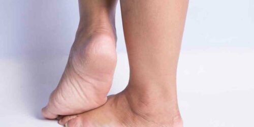 Walk In Stride By Treating Heel Pain