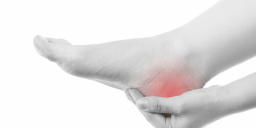 Top 5 Gout Treatment That You Should Start Following Immediately