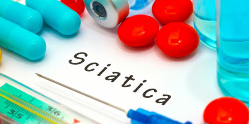 Top Treatment Options for Sciatica