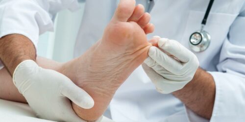 The Best Toenail Fungus Treatment Options For Quick Relief