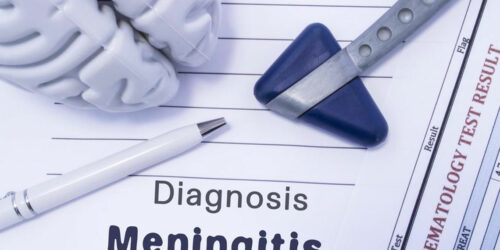 The What and Why of Strep Meningitis