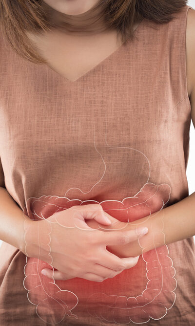 The Types Of Colon Polyps And Their Prevention