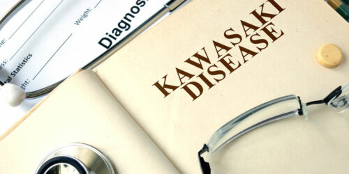 The effect of diet on Kawasaki disease