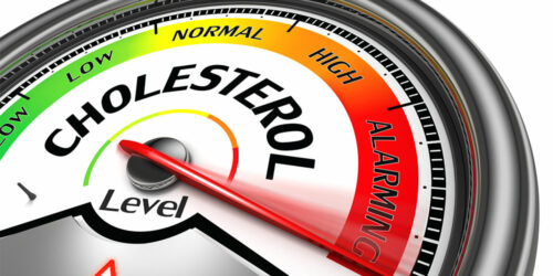 The truth about cholesterol