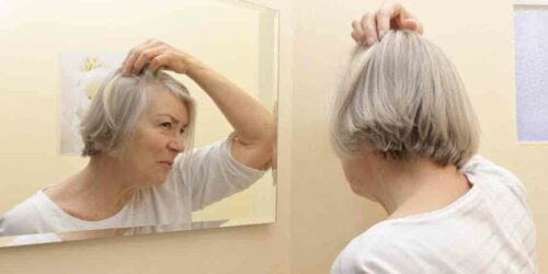 Thinning Hair Solutions &#8211; Watch Out Before It Is Too Late