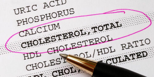 Things You Need To Know About Cholesterol