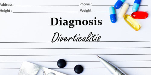 Things to Know about Diverticulitis