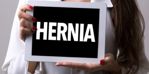 Treatment Options for a Hiatal Hernia